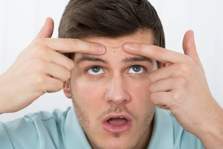 man squeezing pimple between eyebrows
