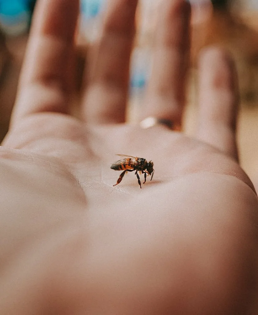a bee biting someone's hand