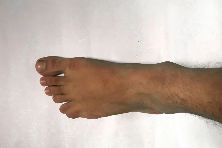 Spiritual Meaning of Six Toes (You Didn't Expect)